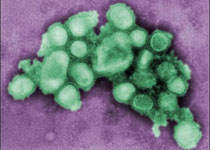 Свиной грипп: скандал вокруг ВОЗ