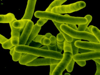 Микобактерии туберкулеза под электронным микроскопом. Фото с сайта www.bio.miami.edu