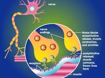 Механизм действия ботулинового токсина на нервные клетки. Изображение с сайта locateadoc.com