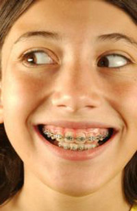 Кривые зубы портят не только внешность