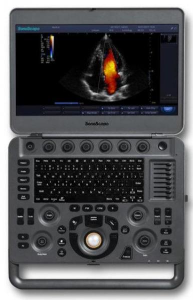 Система ультразвуковой диагностики  Модель: SonoScape Х3