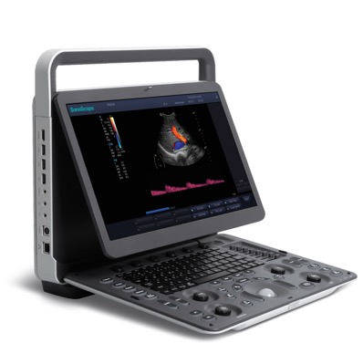 Система ультразвуковой диагностики  Модель: SonoScape E3