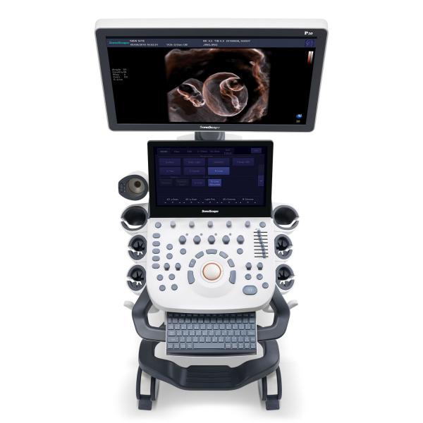 Система ультразвуковой диагностики  Модель: SonoScape P-20