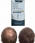 Оригинальное средство для лечения волос Миноксидил 10% Topical Solution (Mitotrexal 10%)