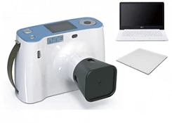 Аппарат рентгеновский переносной DigitalX-ray:uz:Portativ rentgen apparati DigitalX-ray
