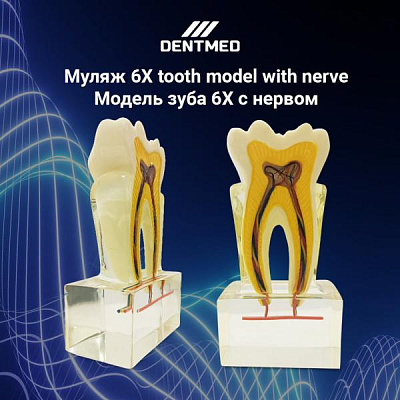 Муляж 6X tooth model with nerve/Модель зуба 6X с нервом