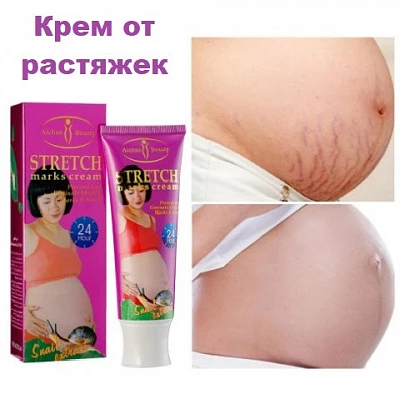 Крем от растяжек с экстрактом улитки Aichun Beauty Крем от растяжек с экстрактом улитки Aichun Beauty:uz:Chandiq va izlarga qarshi shilliq qurt ekstraktili krem Aichun Beauty