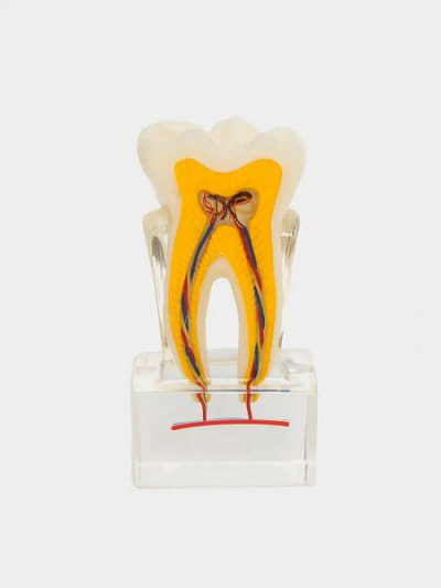 Муляж 6X tooth model with nerve