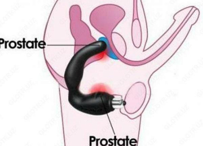 Урологический массажер:uz:Prostata urologik massaji