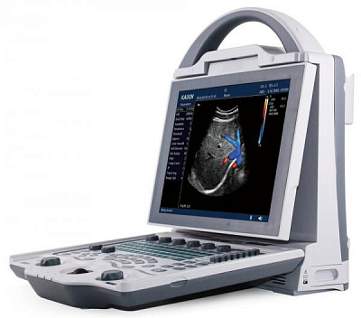 УЗИ портативный с цветным доплером + 2 датчика