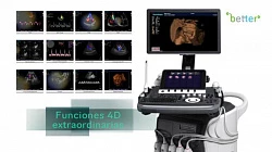 UZI apparatlar Sonoscape