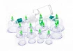 Хиджама:uz:Hijama - bu qon quyish kolbalar
