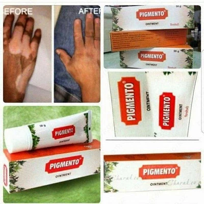 Pigmento  Vitiligoga oq doglarni yoqotish uchun maz Пигменто для ВИТИЛИГО:uz:Pigmento  Vitiligoga oq doglarni yoqotish uchun maz