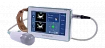 Сканер мочевого пузыря модель: AvantSonic Z3