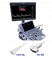 Ультразвуковая система (УЗИ) Acclarix LX3, модель 3:uz:Ultratovush tizimi (ultratovush) Acclarix LX3, 3-model