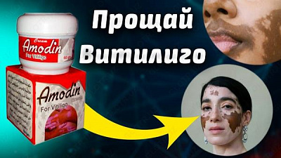Крем для лечения витилиго и восстановления тона кожи "Amodin":uz:Vitiligoni davolash va terining ohangini tiklash uchun krem ​​"Amodin"