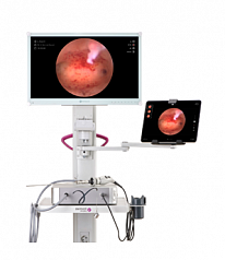 Эндоскопическая видеокамера iCARE:uz:Endoskopik videokamera iCARE