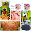 Сафи сироп от псориаз:uz:Safi sirop psoriazdan davolash psariazni yoqotish