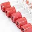 Вакуумные пробирки без наполнителя Improvacuter 5 мл 13х100 мм Красная крышка:uz:To'ldiruvchisiz vakuumli naychalar Improvacuter 5 ml 13x100 mm Qizil qopqoq