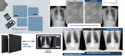 Рентген флет-панели DRTECH EVS3643A