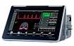 ИВЛ аппараты Imtmedical Bellavista 1000:uz:IVL apparati Imtmedical Bellavista 1000