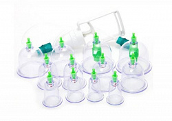 Hijama - bu qon quyish kolbalar
