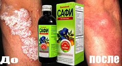 Teri kasalliklariga qarshi va qonni tozalash uchun Safi siropi (100 mg)