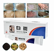 Мазь для лечения белых пятен на теле 20 г