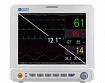 Кардиомонитор UP-7000 (модульный):uz:Kardiyak monitor UP-7000 (modulli)