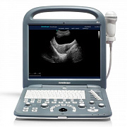 Portativ ultratovush apparati S2