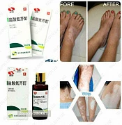 Лосьон для лечения витилиго