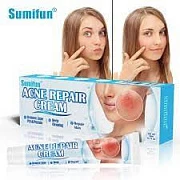 Крем от угрей   Sumifun