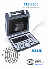 УЗИ-аппарат SIUI GTS 8800