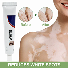 Крем для лечения витилиго White 20 г:uz:Oq-vitiligo davolash uchun krem, 20 g