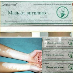 Мазь Хуаяаотан для лечения витилиго:uz:Huayaaotan malhami vitiligo davolash uchun