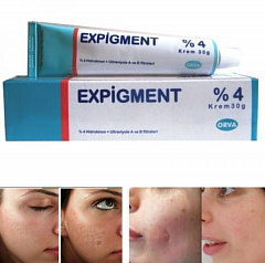 Осветляющий крем Expigment 4% 30 гр.:uz:dog'larni ketkazuvchi  Expigment 4% 30 гр.