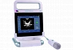 Сканер мочевого пузыря  модель:AvantSonic Z5