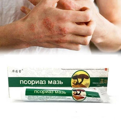 Мазь против псориаза Мазь против псориаза:uz:Psoriazga qarshi ajoyib vosita
