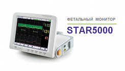 Фетальный монитор STAR5000