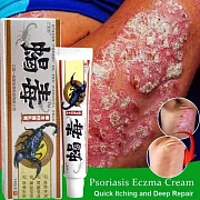 Антибактериальный крем от псориаза Седу (яд скорпиона),18 г