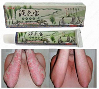 Psoriaz, dermatit, liken, qichishish uchun 