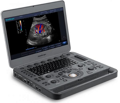 Система ультразвуковой диагностики Модель: SonoScape Х3