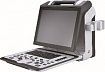 УЗИ-аппарат SIUI A2100 Plus с кардиологией (В сертификации CTS-8800):uz:SIUI A2100 Plus ultratovush apparati kardiologiya bilan (CTS-8800 sertifikatida)