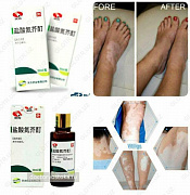 VITILIGO ni davolash uchun damlamasi - Yansuan Danjie Ding