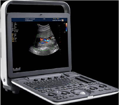 УЗИ портативное MediSono (США)
