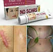 Крем для удаления шрамов No Scars:uz:Izlarni olib tashlash uchun krem No Scars