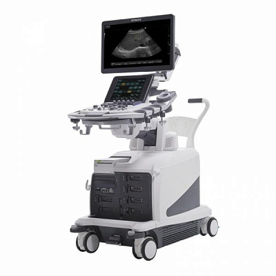 УЗИ аппарат Aloka Arietta 850