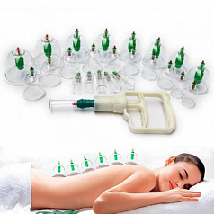 Баночки для хиджама:uz:Hijama amaliyoti uchun qon quyish kolbalar